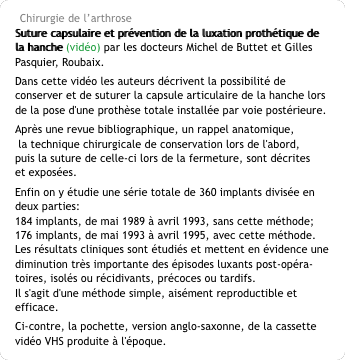 Chirurgie de l’arthrose Suture capsulaire et